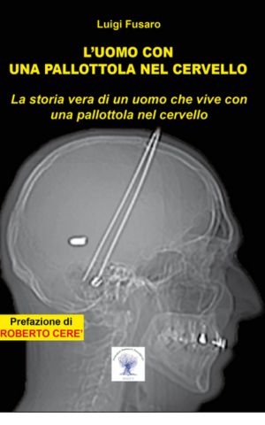 Luis fusaro: l'uomo con la pallottola nel cervello